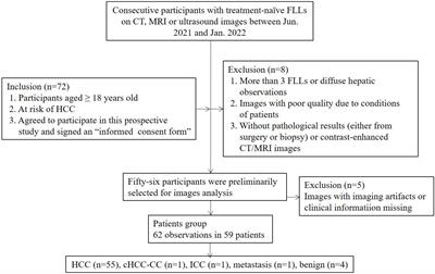 Head-to-head comparison of Sonazoid and SonoVue in the diagnosis of hepatocellular carcinoma for patients at high risk